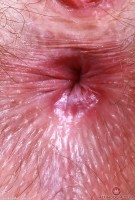 ATK hairy Big Eyes in young and hairy