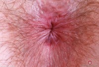 ATK hairy Big Eyes in young and hairy