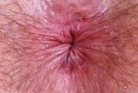 ATK hairy Big Eyes Set