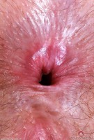 ATK hairy Big Eyes Set