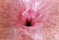 ATK hairy Big Eyes Set