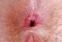 ATK hairy Big Eyes in young and hairy