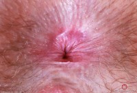 ATK hairy Big Eyes Set