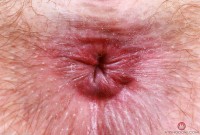 ATK hairy Big Eyes Set