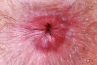 ATK hairy Big Eyes Set