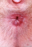 ATK hairy Big Eyes Set