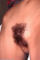 ATK hairy  in young and hairy