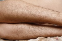 ATK hairy  in young and hairy