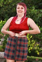 ATK hairy  in mature and hairy