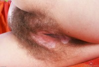 ATK hairy  in mature and hairy