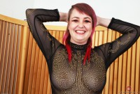 ATK hairy  in mature and hairy