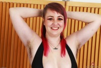 ATK hairy  in mature and hairy