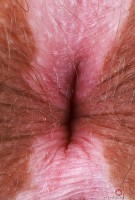 ATK hairy Bratty Wolfie Set