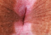 ATK hairy Bratty Wolfie Set