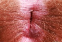 ATK hairy Bratty Wolfie in young and hairy