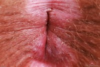 ATK hairy Bratty Wolfie Set