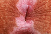 ATK hairy Bratty Wolfie Set