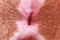 ATK hairy Bratty Wolfie in young and hairy