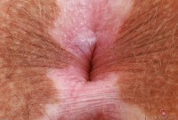 ATK hairy Bratty Wolfie Set