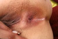 ATK hairy  in young and hairy