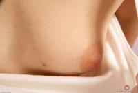 ATK hairy  in young and hairy