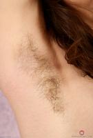 ATK hairy  in young and hairy