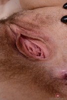ATK hairy  in young and hairy