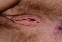 ATK hairy  in young and hairy