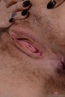 ATK hairy  in young and hairy