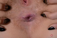 ATK hairy  in young and hairy