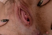 ATK hairy  in young and hairy