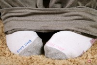 ATK hairy  in young and hairy