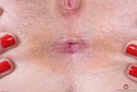 ATK hairy  in young and hairy