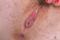 ATK hairy  in young and hairy