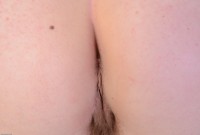 ATK hairy  in young and hairy
