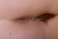 ATK hairy  in young and hairy