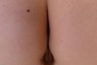 ATK hairy  in young and hairy