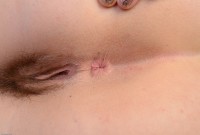 ATK hairy  in young and hairy