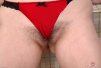 ATK hairy  in young and hairy