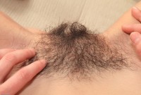ATK hairy  in young and hairy
