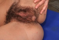 ATK hairy  in young and hairy