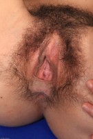 ATK hairy  in young and hairy