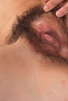 ATK hairy  in young and hairy