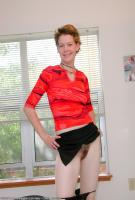 ATK hairy  in mature and hairy