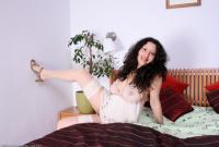 ATK hairy  in mature and hairy