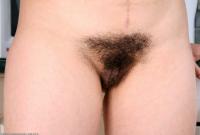 ATK hairy  in mature and hairy