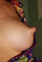 ATK hairy  in mature and hairy