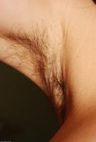 ATK hairy  in mature and hairy