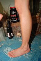 ATK hairy  in mature and hairy