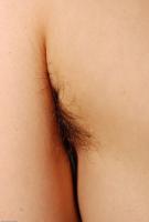 ATK hairy  in mature and hairy